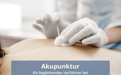 Akupunktur