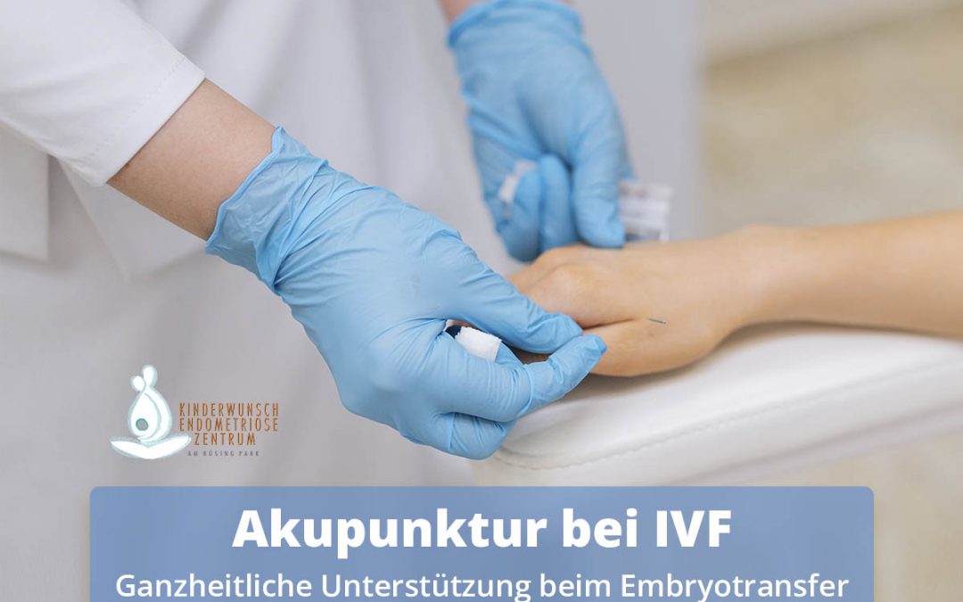 Akupunktur bei IVF und ICSI