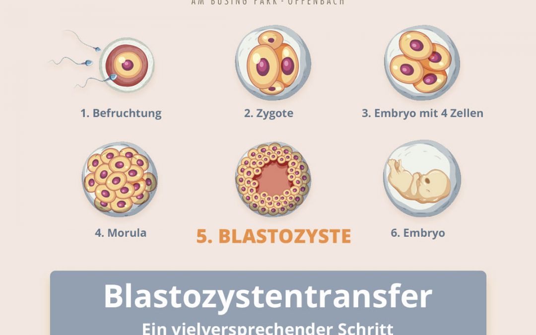 Blastozystentransfer