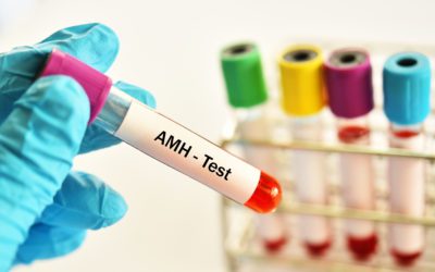 AMH