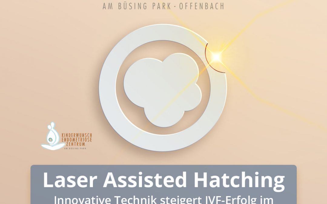 Laser Assisted Hatching