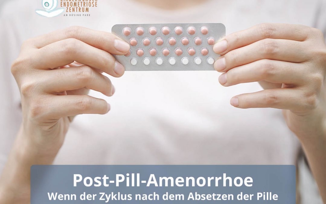 Post-Pill-Amenorrhoe