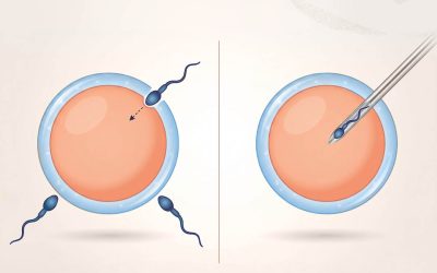 IVF oder ICSI?